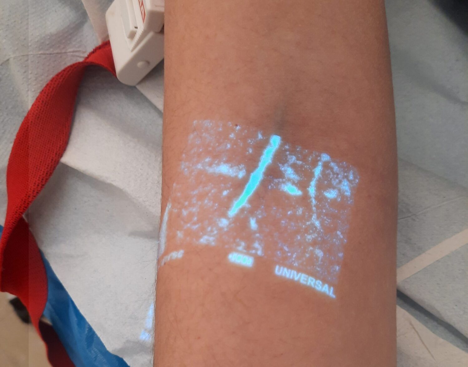 Μηχάνημα ανίχνευσης φλεβών δώρισε στο Κέντρο Υγείας Μελιγαλά η οικογένεια του εκλιπόντος ιατρού Αθανασιου Μπερσή